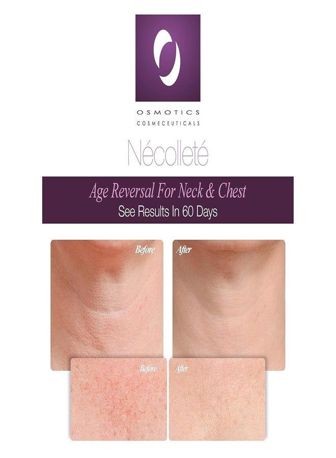 Osmotics Cosmeceuticals Osmotics Nécolleté Age Reversal for Neck and Chest - Firms, Smooths & Tightens Fragile Skin on Neck, Chest & Décolleté | Anti-Aging Formula for Sun Damage - 1.7oz - Image 2